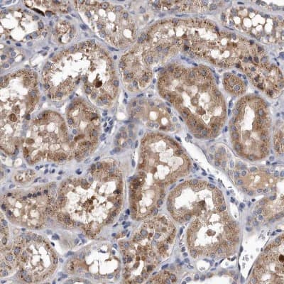Immunohistochemistry-Paraffin: MGAT4A Antibody [NBP1-81809]