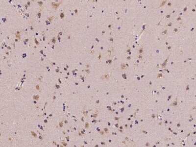 Immunohistochemistry-Paraffin: MGAT4A Antibody [NBP2-97462]