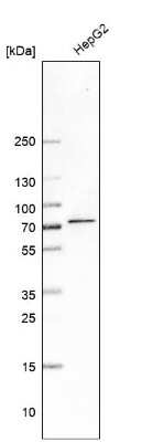 Western Blot: MGAT4A Antibody [NBP1-81809]