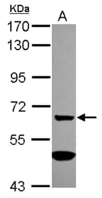 Western Blot: MGAT4A Antibody [NBP2-17285]