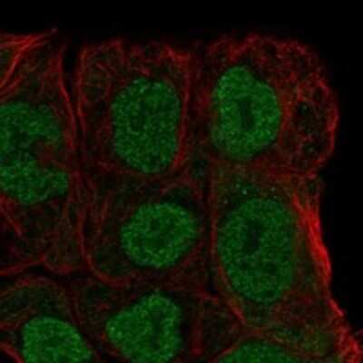 Immunocytochemistry/ Immunofluorescence: MGAT4B Antibody [NBP3-17394]