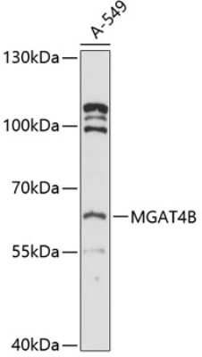 Western Blot: MGAT4B AntibodyAzide and BSA Free [NBP3-05020]