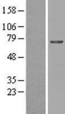 Western Blot: MGAT4B Overexpression Lysate [NBL1-13055]