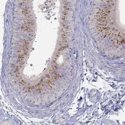 Immunohistochemistry-Paraffin: MGAT4C Antibody [NBP1-93699]