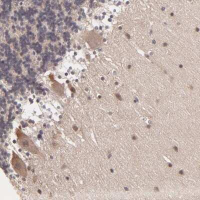 Immunohistochemistry-Paraffin: MGC13138 Antibody [NBP1-92115]