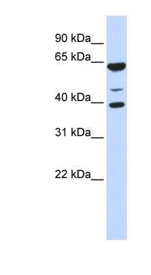 Western Blot: MGC13138 Antibody [NBP1-79709]