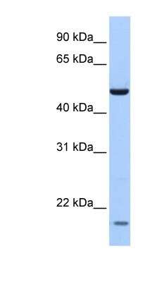 Western Blot: MGC13138 Antibody [NBP1-80133]