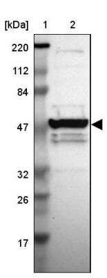 Western Blot: MGC13138 Antibody [NBP1-92115]