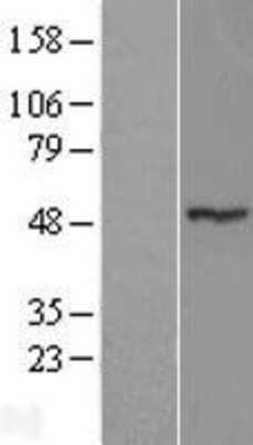 Western Blot: MGC13138 Overexpression Lysate [NBL1-18245]