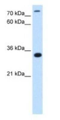 Western Blot: MGC16471 Antibody [NBP1-79269]