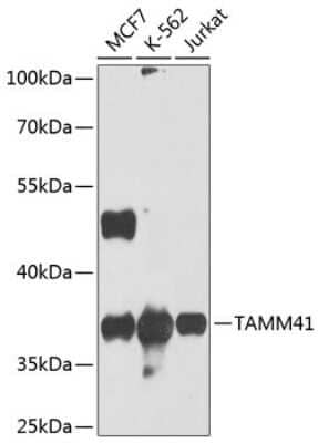 Western Blot: MGC16471 AntibodyBSA Free [NBP3-03615]