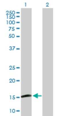 Western Blot: MGC16703 Antibody [H00113691-B01P]