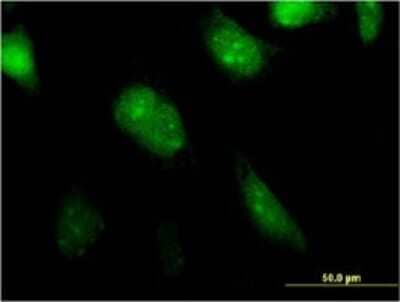 Immunocytochemistry/ Immunofluorescence: MGC20410 Antibody (1B11) [H00116071-M01]