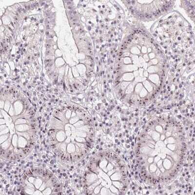 Immunohistochemistry-Paraffin: MGC20410 Antibody [NBP2-38963]