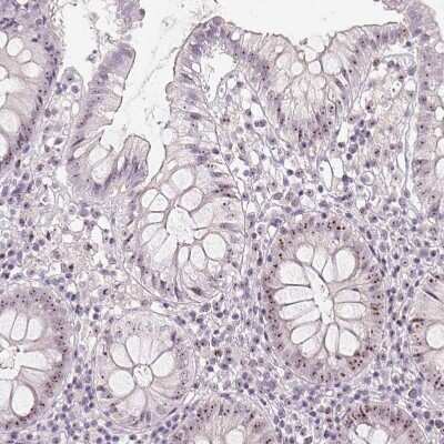 Immunohistochemistry-Paraffin: MGC20410 Antibody [NBP2-38963]