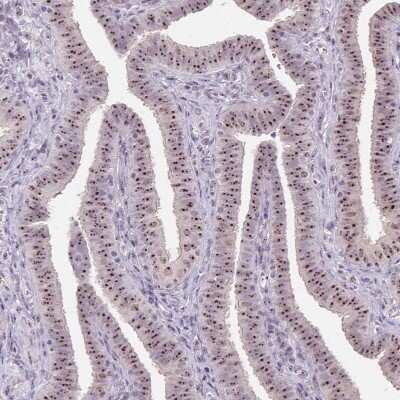 Immunohistochemistry-Paraffin: MGC20410 Antibody [NBP2-38963]