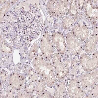 Immunohistochemistry-Paraffin: MGC20410 Antibody [NBP2-38963]