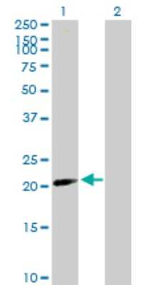 Western Blot: MGC20410 Antibody [H00116071-B02P]