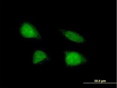 Immunocytochemistry/ Immunofluorescence: MGC2803 Antibody [H00079002-B01P]