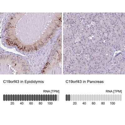 Immunohistochemistry-Paraffin: MGC2803 Antibody [NBP2-31806]