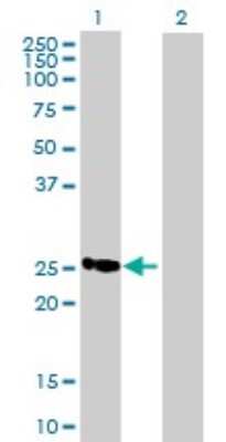 Western Blot: MGC2803 Antibody [H00079002-B01P]