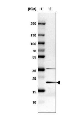 Western Blot: MGC2803 Antibody [NBP2-31806]