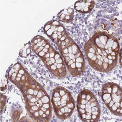 Immunohistochemistry: MGC4172 Antibody [NBP2-30577]