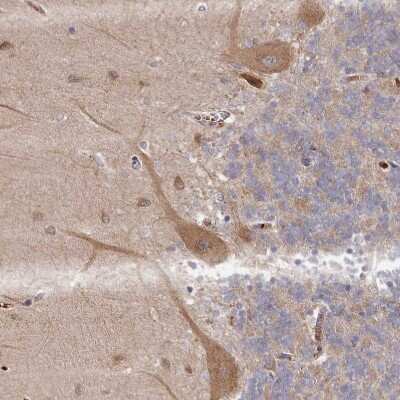 Immunohistochemistry-Paraffin: MGC4172 Antibody [NBP2-30446]