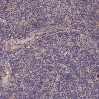 Immunohistochemistry-Paraffin: MGC4172 Antibody [NBP2-30446]