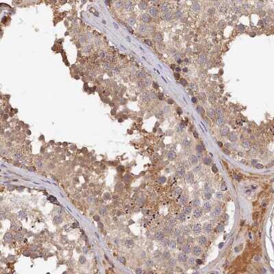 Immunohistochemistry-Paraffin: MGC4172 Antibody [NBP2-30446]