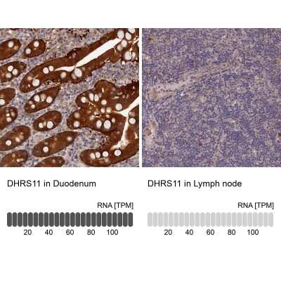 Immunohistochemistry-Paraffin: MGC4172 Antibody [NBP2-30446]