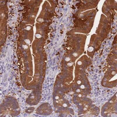 Immunohistochemistry-Paraffin: MGC4172 Antibody [NBP2-30577]