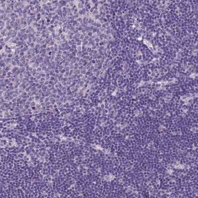 Immunohistochemistry-Paraffin: MGC4172 Antibody [NBP2-30577]