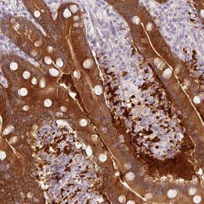 Immunohistochemistry-Paraffin: MGC4172 Antibody [NBP2-30686]