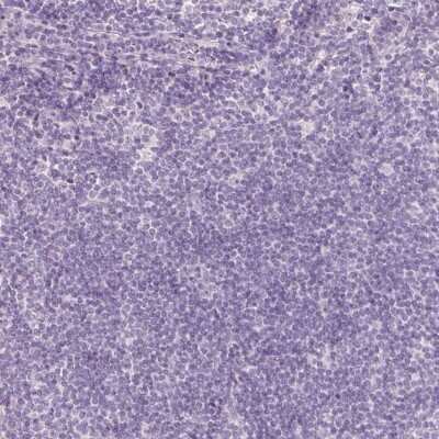 Immunohistochemistry-Paraffin: MGC4172 Antibody [NBP2-30686]