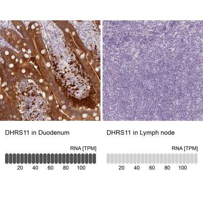 Immunohistochemistry-Paraffin: MGC4172 Antibody [NBP2-30686]