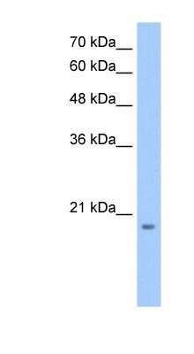 Western Blot: MGC4172 Antibody [NBP1-60061]