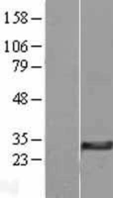 Western Blot: MGC4172 Overexpression Lysate [NBL1-13074]