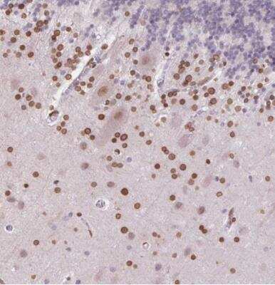 Immunohistochemistry-Paraffin: MGC4618 Antibody [NBP2-49247]