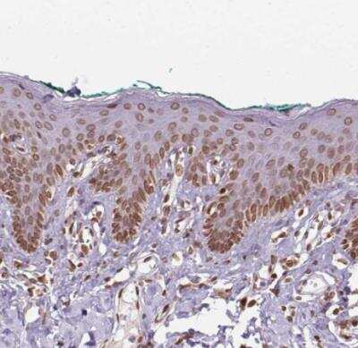 Immunohistochemistry-Paraffin: MGC4618 Antibody [NBP2-49247]
