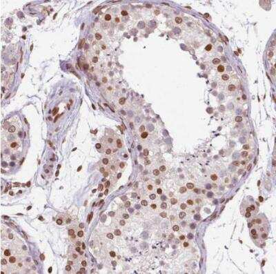 Immunohistochemistry-Paraffin: MGC4618 Antibody [NBP2-49247]