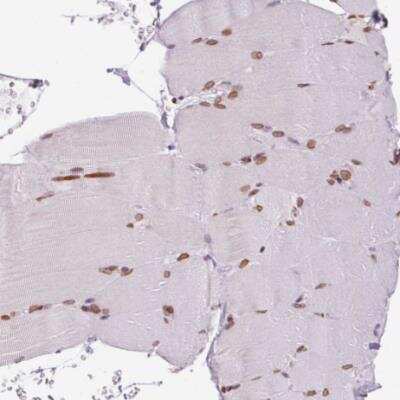 Immunohistochemistry-Paraffin: MGC4618 Antibody [NBP2-49247]