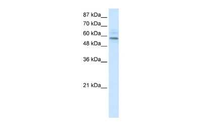 Western Blot: MGC4618 Antibody [NBP2-85279]