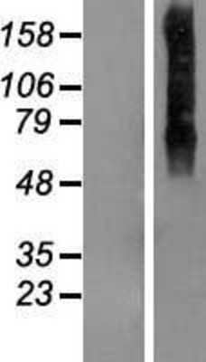 Western Blot: MGC4618 Overexpression Lysate [NBP2-06045]