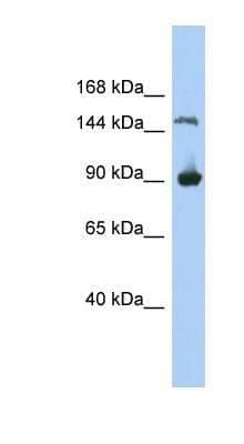 Western Blot: MGC50722 Antibody [NBP1-91472]