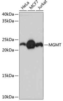 Western Blot: MGMT Antibody (2A4X3) [NBP3-15348]