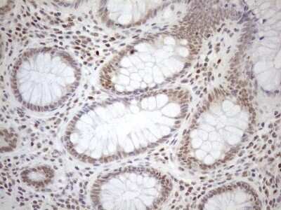 Immunohistochemistry: MGMT Antibody (OTI4F9) [NBP2-45843]