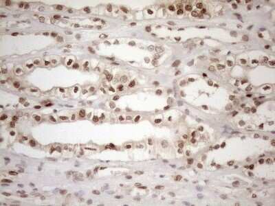 Immunohistochemistry: MGMT Antibody (OTI4F9) [NBP2-45843]