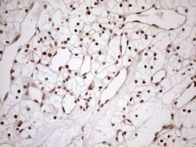 Immunohistochemistry: MGMT Antibody (OTI4F9) [NBP2-45843]