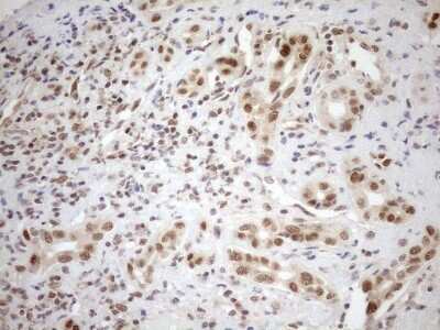Immunohistochemistry: MGMT Antibody (OTI4F9) [NBP2-45843]